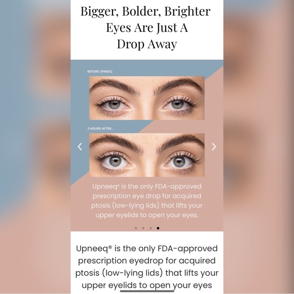 Upneeq Skincare Bright Eyes Upneeq Drops Fix Droopy Eyelids Ptosis